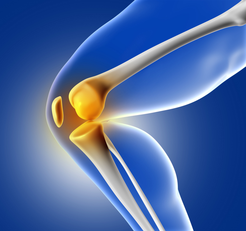 Artroplastia total o parcial de rodilla en Ciudad de México: Una solución para el dolor articular
