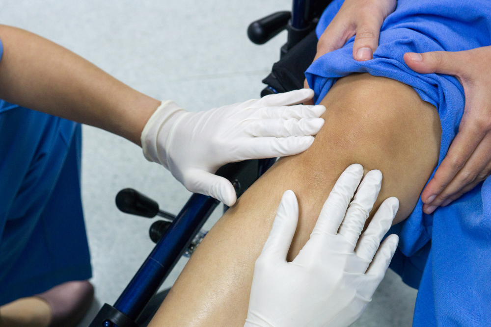 Reconstrucción de ligamento cruzado anterior (LCA), ligamentos colaterales y anterolateral de rodilla en Ciudad de México: Solución para lesiones complejas