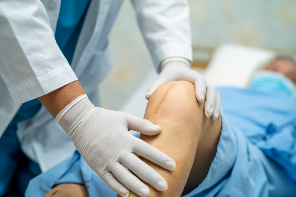 Revisión de artroplastia de cadera o rodilla en Ciudad de México: Solución para complicaciones postquirúrgicas